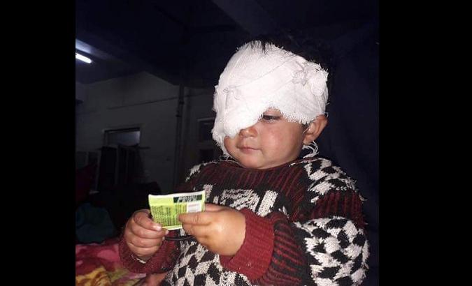 Eighteen-month old Hiba Jan is the youngest victim of Indian army's pellet guns in Indian Occupied Kashmir.
