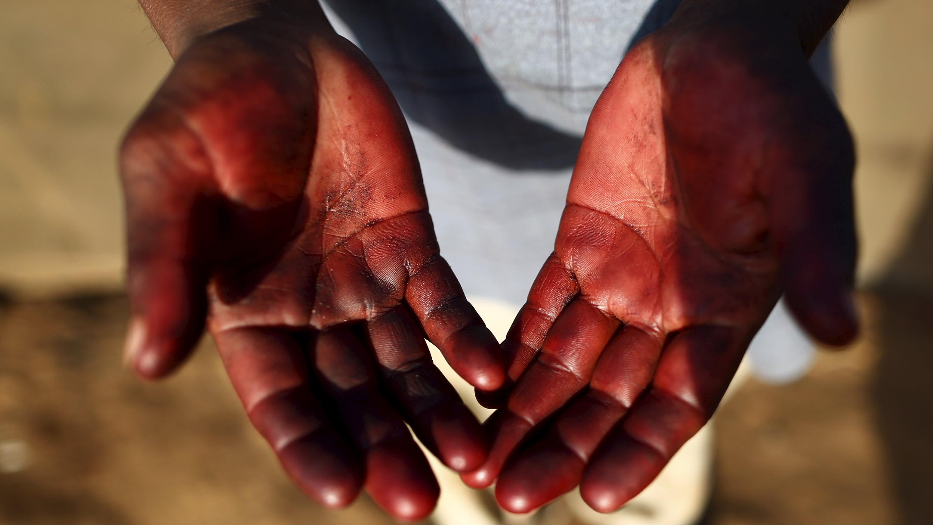 Genaro Perfecto, who works as a fruit picker, shows his hands which are stained with strawberry juice in San Quintin in Baja California state, Mexico April 1, 2015.