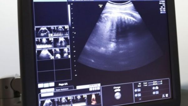 Currently 24 U.S. states require that an ultrasound be performed before performing an abortion procedure. 