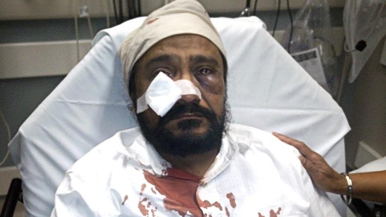Inderjit Singh Mukker was hospitalized after being punched in the face by an assailant who allegedly yelled “Terrorist, go back to your country.”