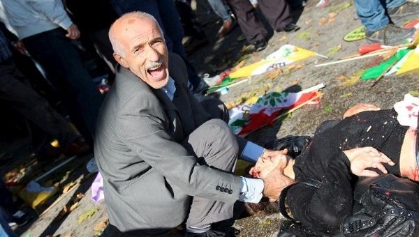 A man asks for help after an explosion during a peace march in Ankara, Oct. 10, 2015.