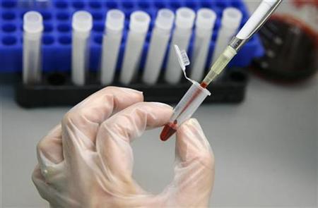 A laboratory technician examines blood samples for HIV/AIDS in a public hospital