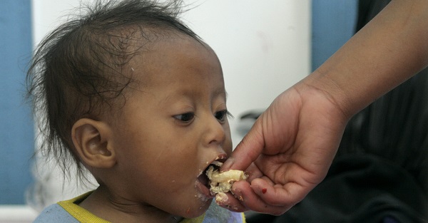 Almost half of children under five in Guatemala suffer from chronic malnutrition.