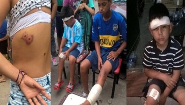 A composite image of pictures shared on social media show some of the injuries sustained by children at the hands of Argentine police.