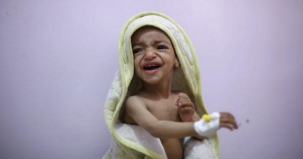 A malnourished boy cries as he sits on a bed at a malnutrition intensive care unit in Yemen's capital Sanaa in this February 10, 2016 file photo.