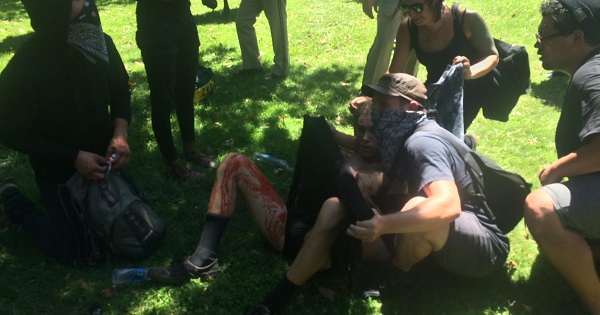 A counter-demonstrator described as an Antifa activist lies in the grass after being allegedly stabbed by a supporter of the far-right Traditionalist Worker Party, Sacramento, California, June 26, 2016.