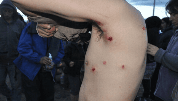 Argentina's militarized police illegally shot activists with rubber bullets at point-blank range.