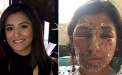 21 year old Resham Khan and her cousin were attacked on June 21 spurring activists to call for corrosive substances ban