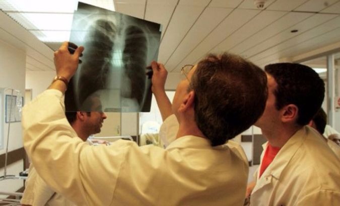 Doctors looking at an X-Ray of lungs. FILE