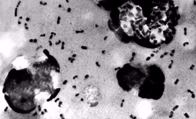 US Centers For Disease Control file image shows the bubonic plague bacteria.