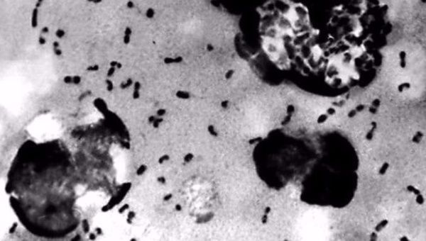 US Centers For Disease Control file image shows the bubonic plague bacteria. 