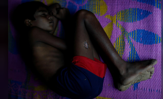 Curled up in a ball, 11-year-old Allah shows a large, livid scar on his right thigh: the result of a gunshot wound. “They sprayed us with bullets as our house was burning,” his mother Samara said.  “It was a bullet half the size of my index finger. I can’t stop thinking, why did God put us in that dangerous situation?”
