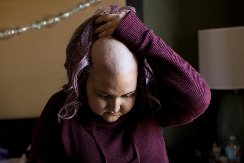 Keyshla Betancourt Irizarry, 22, came to Florida in October on a humanitarian flight with her mother and brother. Suffering with the blood cancer Hodgkin’s Lymphoma, Betancourt was deteriorating fast on an island whose healthcare system is in tatters.
