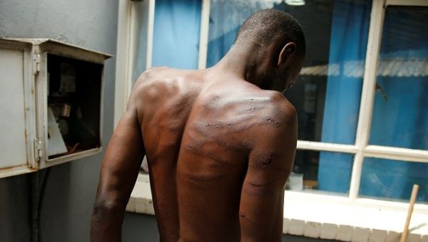 An arrested, injured man is seen at a hospital following protests in Harare, Zimbabwe, January 16, 2019.