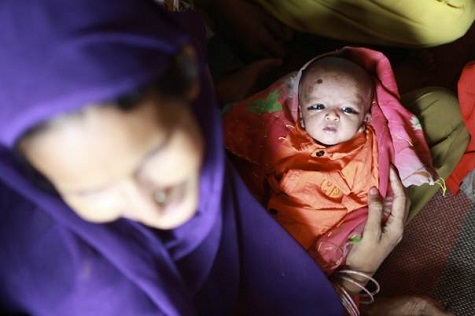 Female infanticide is common in India where more than 600,000 girls are estimated to be missing every year.