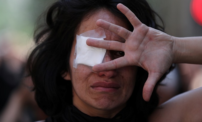 A performer wearing an eyepatch covers her face as part of a protest supporting people who have lost an eye during protests in Santiago, Chile, Nov. 12, 2019.