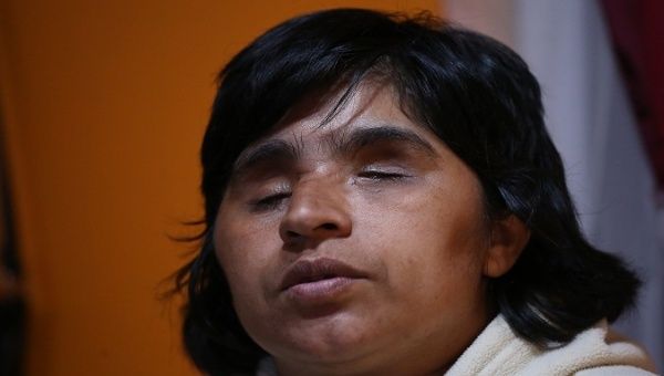 Fabiola Campillai blinded as a result of an attack with a tear gas canister, Santiago, Chile, August 28, 2020. 