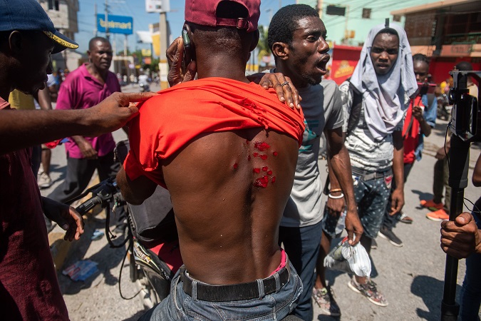 A demonstrator shows his wounds during an anti-governmental protests on October 17 in the capital Port au Prince