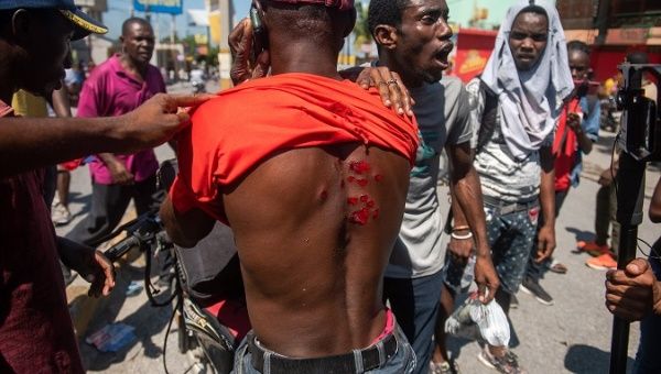 A demonstrator shows his wounds during an anti-governmental protests on October 17 in the capital Port au Prince