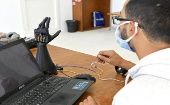 Cure Bionics espera comercializar sus primeras manos biónicas en unos meses, primero en Túnez y luego en el resto del continente.