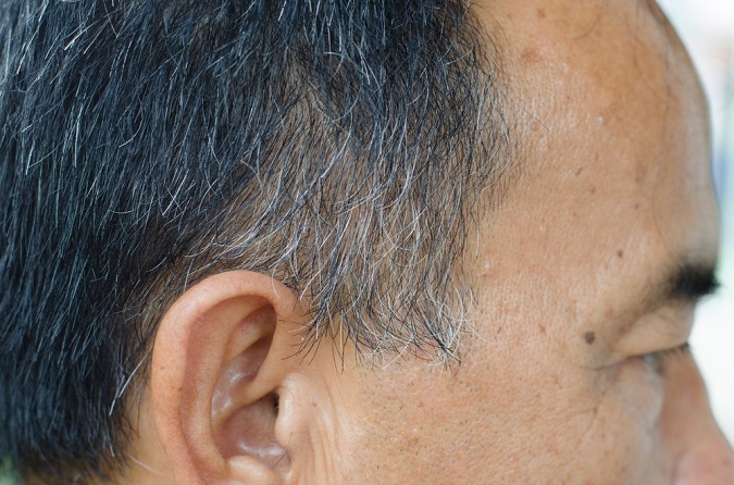 Although several experts had linked grey hair to stress, its appearance was thought to be irreversible, something debunked in the study.