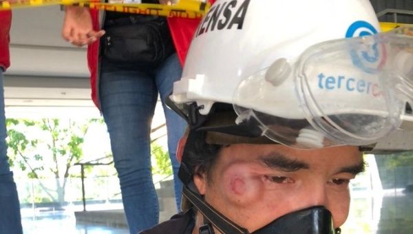 Third Channel reporter hit by a tear gas canister, Medellin, Colombia, June 28, 2021. 
