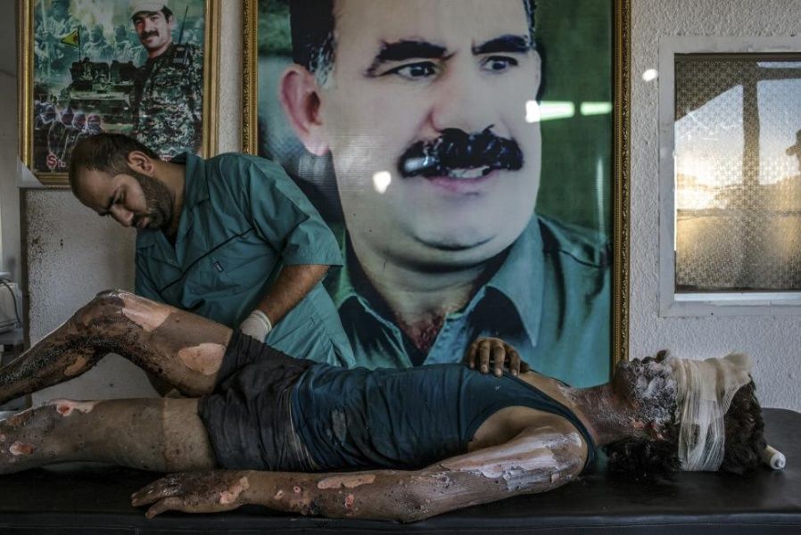 General News, 1st prize singles, World Press Photo Awards: Mauricio Lima - IS Fighter Treated at Kurdish Hospital. A doctor rubs ointment on the burns of Jacob, 16, in front of a poster of Abdullah Ocalan, the jailed leader of the Kurdistan Workers' Party, at a YPG hospital compound on the outskirts of Hasaka August 1, 2015. 